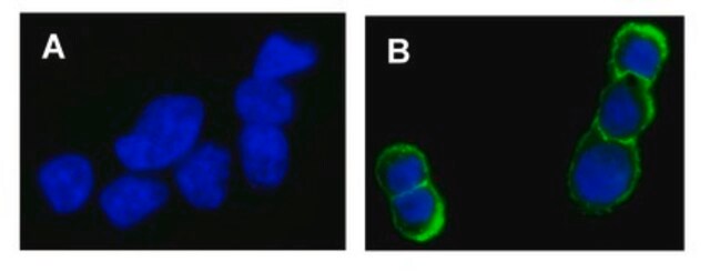 Anti-phospho-erbB-2/HER-2 (Tyr1248) Antibody, Alexa Fluor&#8482; 488 Upstate&#174;, from rabbit