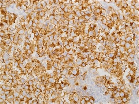 PLAP (EP194) Rabbit Monoclonal Primary Antibody