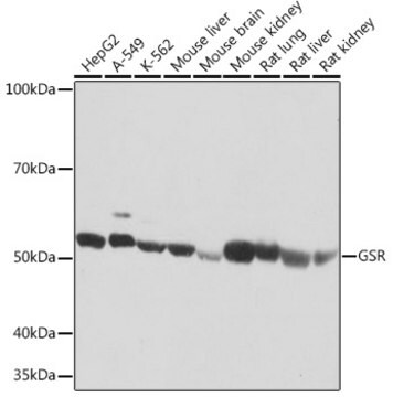 Anti-GSR Antibody, clone 2J5N9, Rabbit Monoclonal