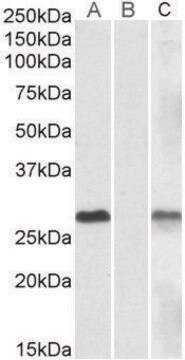 Anti-DYDC1 antibody produced in goat affinity isolated antibody, buffered aqueous solution