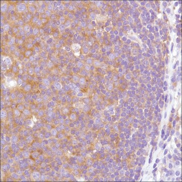 Anti-VPAC2 antibody, Rabbit monoclonal clone SP235, recombinant, expressed in proprietary host, affinity isolated antibody