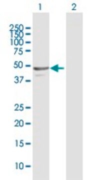 Anti-NAPRT1 antibody produced in rabbit purified immunoglobulin, buffered aqueous solution