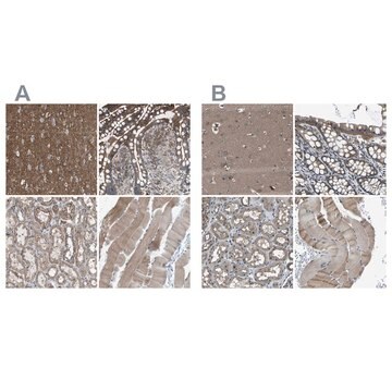 Anti-MYO18A antibody produced in rabbit Prestige Antibodies&#174; Powered by Atlas Antibodies, affinity isolated antibody, buffered aqueous glycerol solution, Ab1