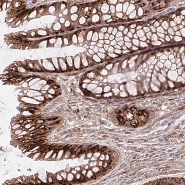 Anti-ASAP1 antibody produced in rabbit Prestige Antibodies&#174; Powered by Atlas Antibodies, affinity isolated antibody, buffered aqueous glycerol solution