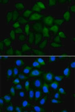 Anti-AFP antibody produced in rabbit