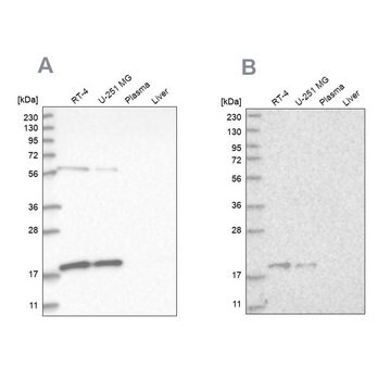 Anti-MRPS10 antibody produced in rabbit Prestige Antibodies&#174; Powered by Atlas Antibodies, affinity isolated antibody, buffered aqueous glycerol solution, ab2