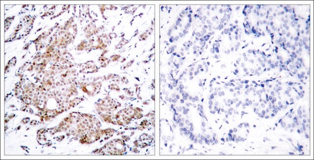 Anti-phospho-MYC (pThr58) antibody produced in rabbit affinity isolated antibody