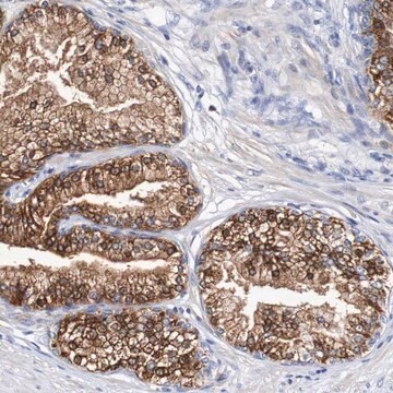 抗ACVR1C ウサギ宿主抗体 Prestige Antibodies&#174; Powered by Atlas Antibodies, affinity isolated antibody, buffered aqueous glycerol solution