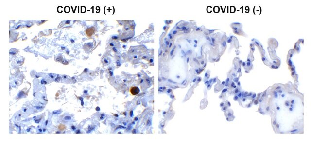 Anti-SARS-CoV-2 (COVID-19) NSP13 (Helicase) antibody produced in rabbit affinity isolated antibody