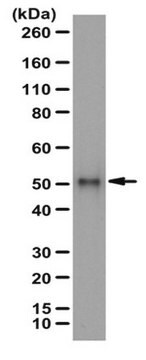 Anti-SPTLC1 Antibody serum, from rabbit