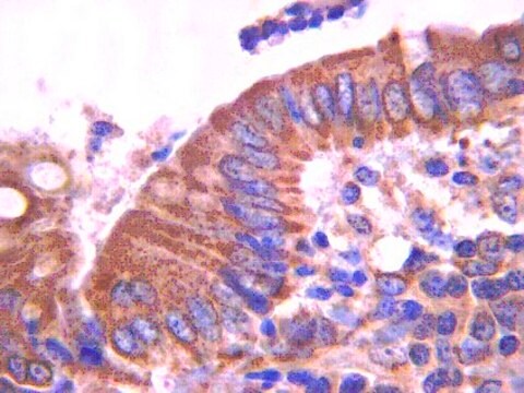 Anticorps anti-E-cadhérine, clone&nbsp;DECMA-1 clone Decma-1, from rat