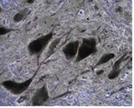 Anti-Tryptophan-Hydroxylase&nbsp;2-Antikörper from rabbit, purified by affinity chromatography