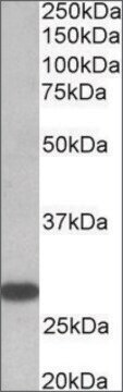 Anti-TSHR antibody produced in goat affinity isolated antibody, buffered aqueous solution