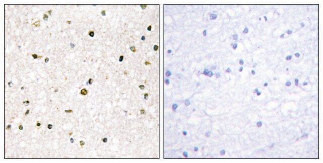 Anti-AKAP11 antibody produced in rabbit affinity isolated antibody