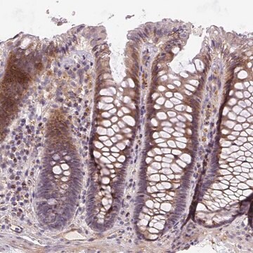 Anti-RNF170 antibody produced in rabbit Prestige Antibodies&#174; Powered by Atlas Antibodies, affinity isolated antibody, buffered aqueous glycerol solution