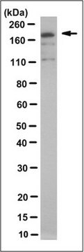 Anti-MRP8 Antibody/ABCC11, clone 2 clone 2, from mouse