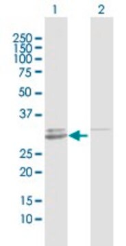 Anti-GALNT12 antibody produced in rabbit purified immunoglobulin, buffered aqueous solution