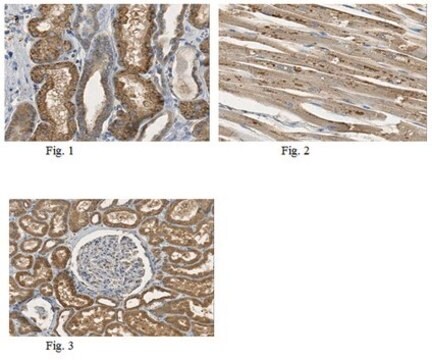 Anti-ASAH1 Antibody from rabbit, purified by affinity chromatography