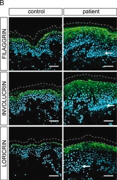 Monoclonal Anti-Involucrin antibody produced in mouse clone SY5, ascites fluid