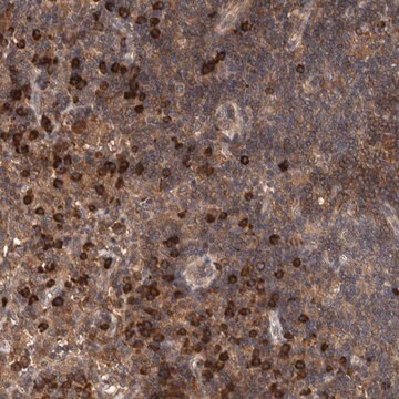 Anti-PLA2G3 antibody produced in rabbit Prestige Antibodies&#174; Powered by Atlas Antibodies, affinity isolated antibody, buffered aqueous glycerol solution