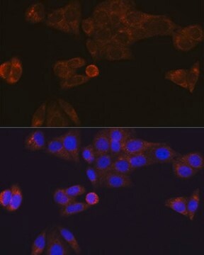 Anti-CES1 antibody produced in rabbit