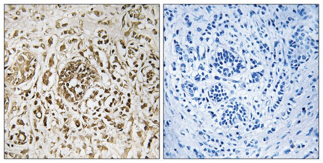 抗-CIB2 兔抗 affinity isolated antibody