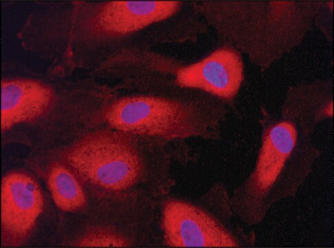 Anti-HRD1/SYVN1 antibody produced in rabbit ~1.0&#160;mg/mL, affinity isolated antibody, buffered aqueous solution