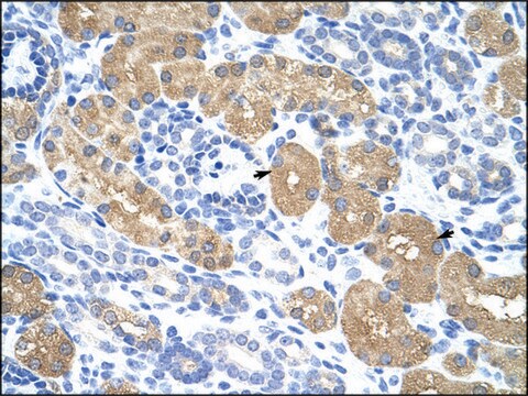 Anti-RAE1 (AB1) antibody produced in rabbit affinity isolated antibody