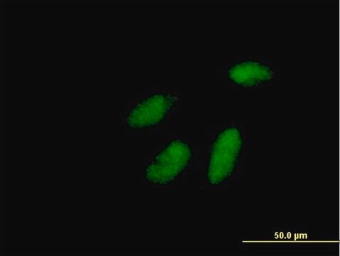 Anti-RAD1 antibody produced in mouse purified immunoglobulin, buffered aqueous solution