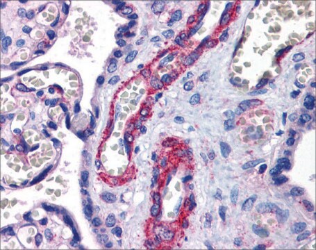 Anti-SUZ12 antibody produced in rabbit affinity isolated antibody