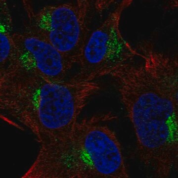 Anti-SPRY4 antibody produced in rabbit Prestige Antibodies&#174; Powered by Atlas Antibodies, affinity isolated antibody