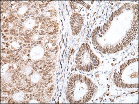 Anty-GLI1 affinity isolated antibody