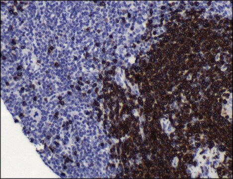 Anti-CD79A antibody, Rabbit monoclonal recombinant, expressed in proprietary host, clone SP18, tissue culture supernatant