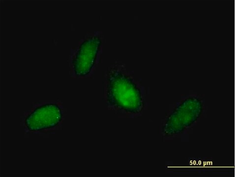 Anti-RNF114 antibody produced in mouse purified immunoglobulin, buffered aqueous solution