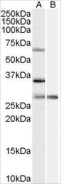 Anti-PRPF31 antibody produced in goat affinity isolated antibody, buffered aqueous solution