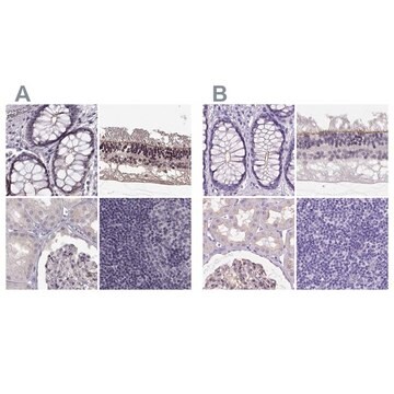 Anti-MPP5 antibody produced in rabbit Prestige Antibodies&#174; Powered by Atlas Antibodies, affinity isolated antibody, buffered aqueous glycerol solution