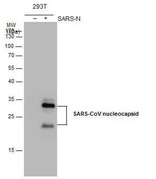 Przeciwciało monoklonalne przeciwkonukleokapsydowi SARS-CoV clone 6H3, affinity isolated antibody