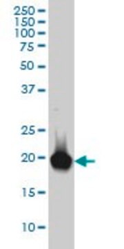 Monoclonal Anti-RBP4, (C-terminal) antibody produced in mouse clone 1E9, purified immunoglobulin, buffered aqueous solution