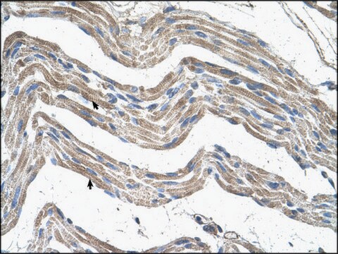 Anti-IDH3A antibody produced in rabbit IgG fraction of antiserum