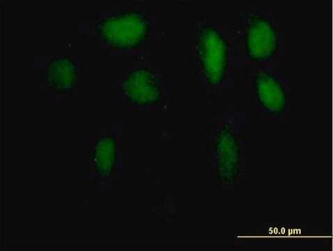 Anti-ZKSCAN5 antibody produced in mouse purified immunoglobulin, buffered aqueous solution