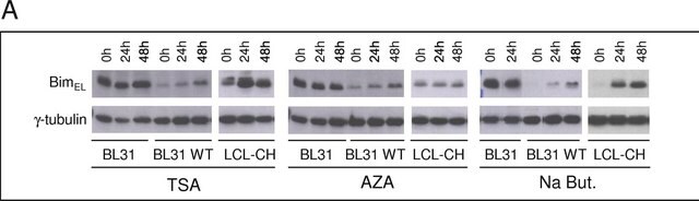 抗&#947;チューブリン抗体、マウスモノクローナル マウス宿主抗体 clone GTU-88, ascites fluid