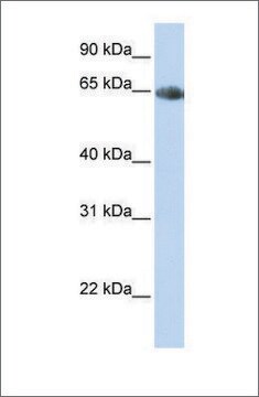 抗SLC6A2抗体 ウサギ宿主抗体 affinity isolated antibody