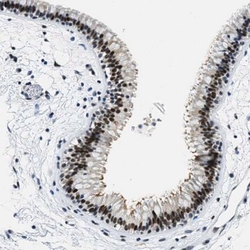 Anti-SSB antibody produced in rabbit Prestige Antibodies&#174; Powered by Atlas Antibodies, affinity isolated antibody, buffered aqueous glycerol solution