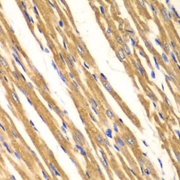 Anti-SOD2 antibody produced in rabbit