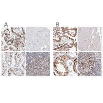 Anti-SMARCC1 antibody produced in rabbit Prestige Antibodies&#174; Powered by Atlas Antibodies, affinity isolated antibody, buffered aqueous glycerol solution