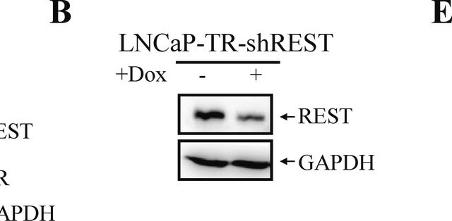 Anticuerpo anti-REST from rabbit, purified by affinity chromatography