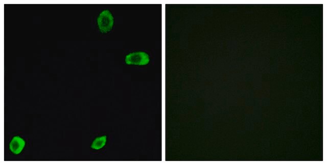 Anti-TAS2R39 antibody produced in rabbit affinity isolated antibody