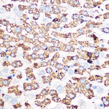 Anti-GLUD1 antibody produced in rabbit