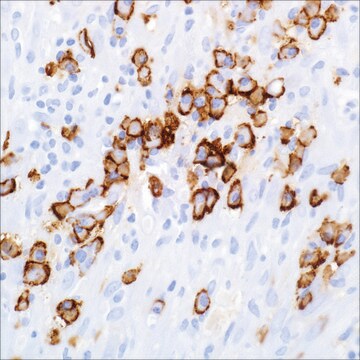 CD138/Syndecan-1 (B-A38) Mouse Monoclonal Antibody