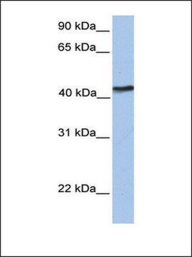 Anti-TMEM149 antibody produced in rabbit affinity isolated antibody